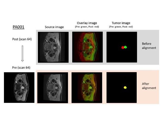 MRI-based Rectal Cancer Diagnosis